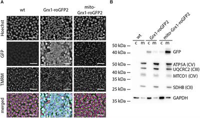 Optogenetic Monitoring of the Glutathione Redox State in Engineered Human Myocardium